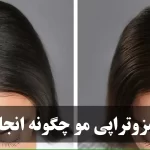 مزوتراپی مو چگونه انجام می‌شود؟