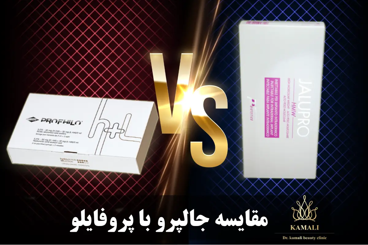مقایسه جالپرو با پروفایلو