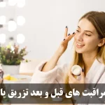 مراقبت‌های قبل و بعد از مزوتراپی یانگ آی