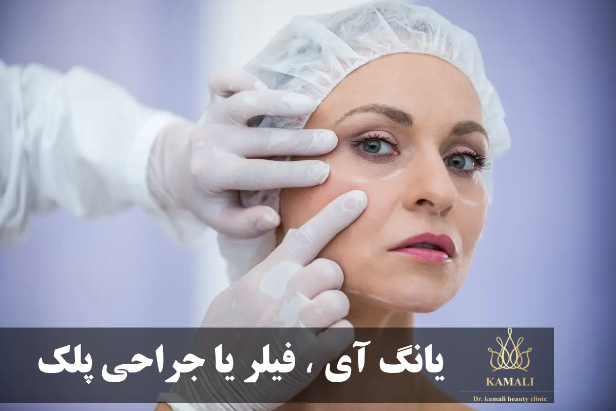 مقایسه یانگ آی با فیلر و جراحی پلک