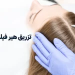 تزریق هیر فیلر در تهران برای تقویت مو و کاهش ریزش مو