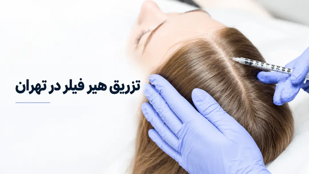 تزریق هیر فیلر در تهران
