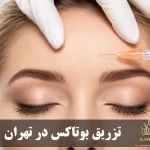 بهترین دکتر بوتاکس در شمال تهران | رزرو نوبت
