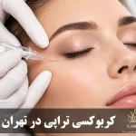 کربوکسی تراپی در تهران | هزینه، کاربردها، تعداد جلسات و رزرو نوبت